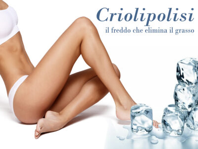 Criolipolisi, l’alternativa alla liposuzione -20% di grasso