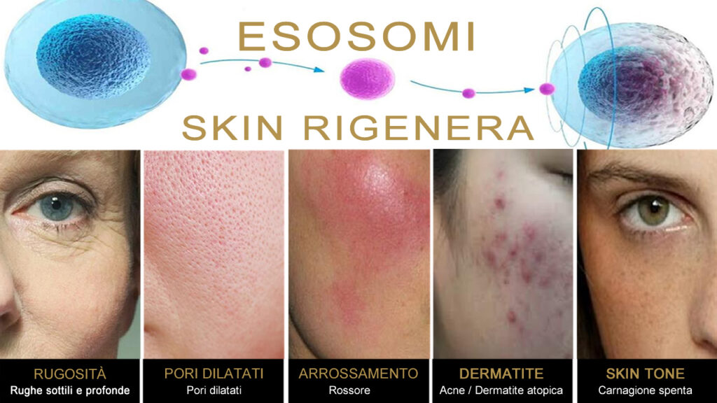 Esosomi Skin Rigenera